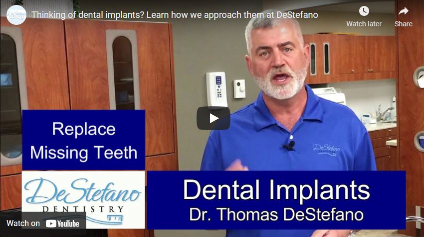 Dental Implants video